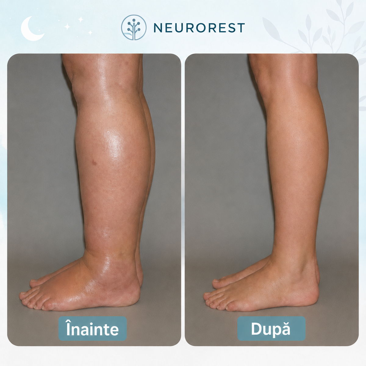 NeuroRest